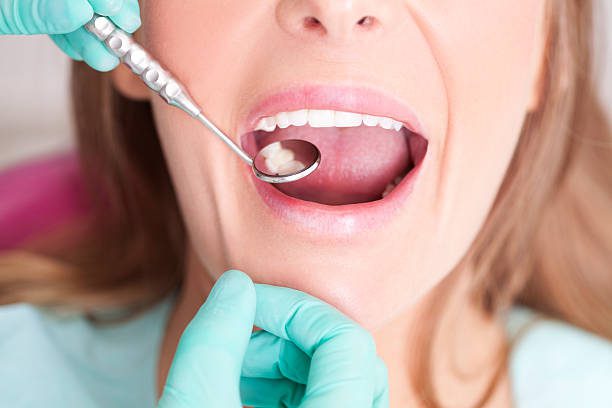 teeth filling price in islamabad