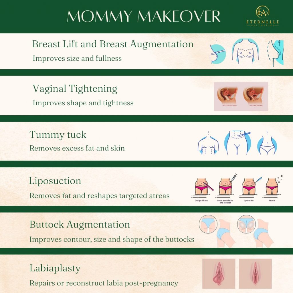 double chin reduction and liposuction and Mommy Makeover