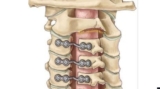 Best Cervical Spine Surgeon in India Explains the Benefits of Personalized Surgical Planning