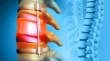 Best Neuro Spine Surgeon in Kolkata – Expert Care