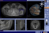 CBCT Dental Imaging Market Global Trends Growth Opportunities and Top Dominating Companies to 2023