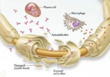 Chronic Inflammatory Demyelinating Polyneuropathy (CIDP) Market Factor Analysis, Region and Forecasts Till 2022
