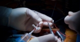 Vascular Graft Market Size, Trends and Technology Insights Report 2019 by Major Key Players by MRFR Research to 2023
